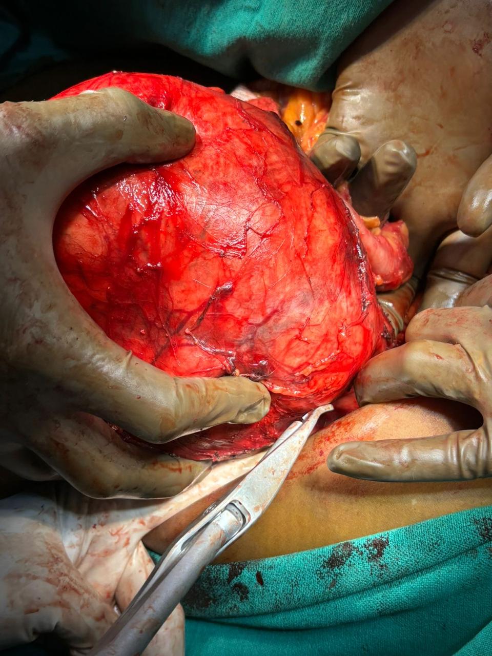 Dr. Nikhilesh Jibhakate Urologist In Nagpur - Jibhakate Urocare Centre - Andrologist, and Renal Transplant Surgeon Nagpur MH 6