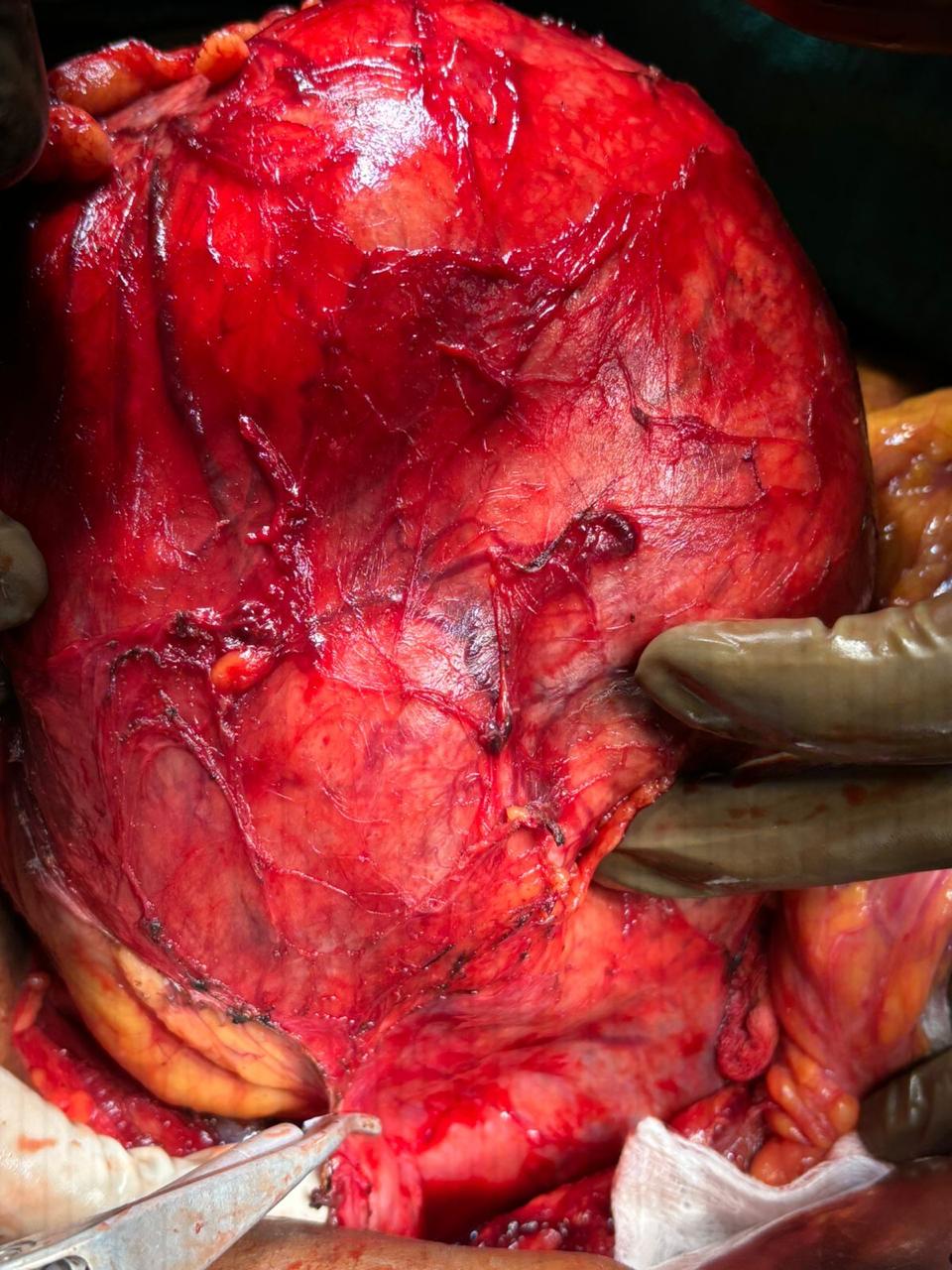 Dr. Nikhilesh Jibhakate Urologist In Nagpur - Jibhakate Urocare Centre - Andrologist, and Renal Transplant Surgeon Nagpur MH 7