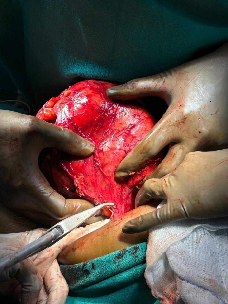 Dr. Nikhilesh Jibhakate Urologist In Nagpur - Jibhakate Urocare Centre - Andrologist, and Renal Transplant Surgeon Nagpur MH 8