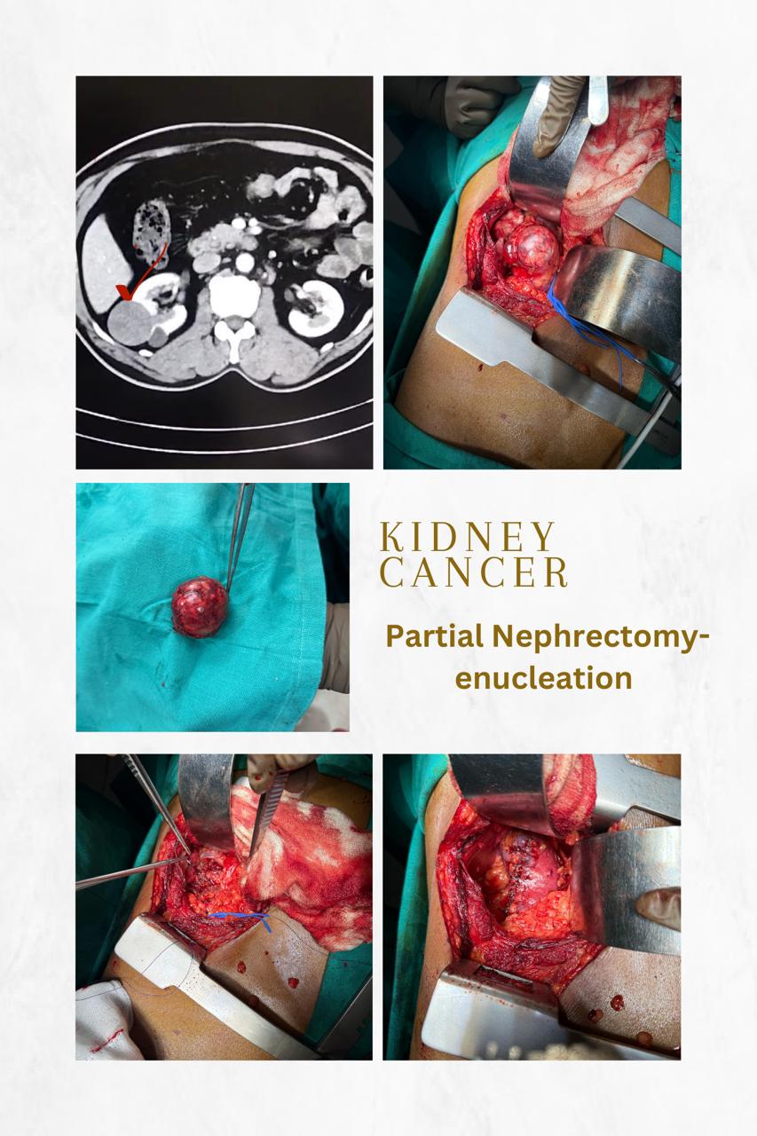 Dr. Nikhilesh Jibhakate Urologist In Nagpur Jibhakate Urocare Centre - Andrologist, and Renal Transplant Surgeon